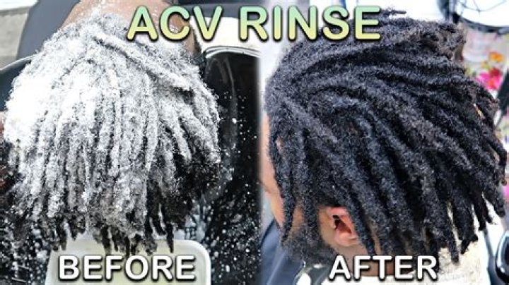 ACV wash for locs ACV wash for locs