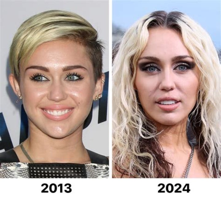 Amanda Bynes Requested The Same Grill As Miley Cyrus