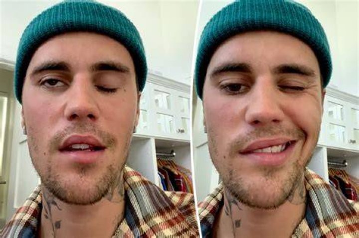 Did Justin Bieber Die Today 2024? A Deep Dive Into The Rumors