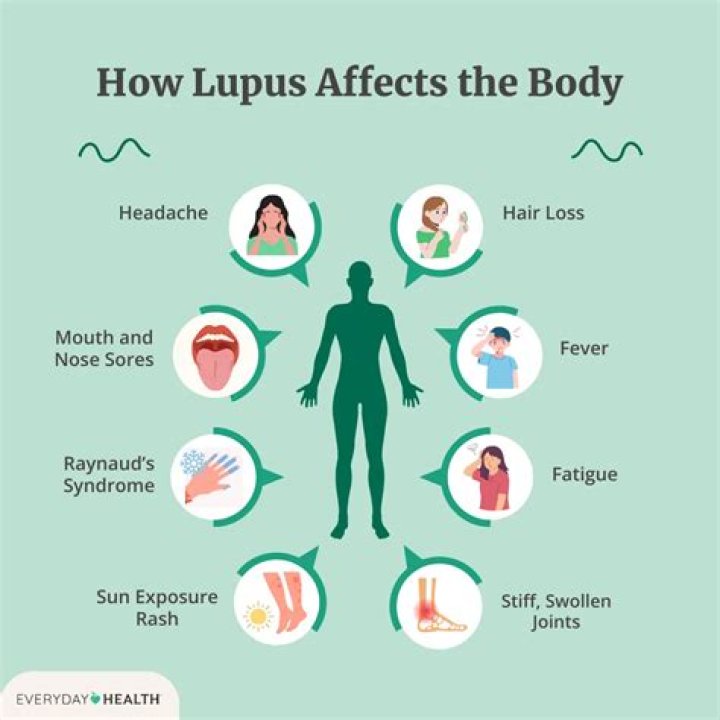 Does Lupus Medication Cause Weight Gain?