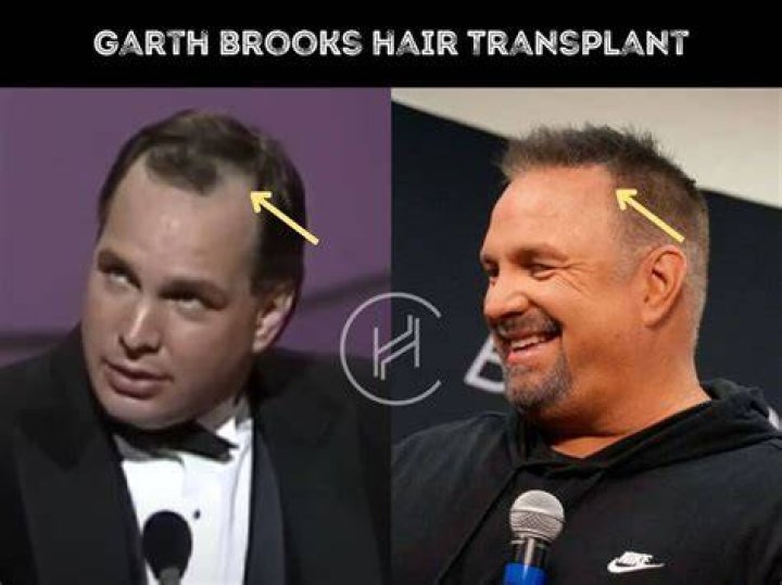 garth brooks before and after garth brooks before and after