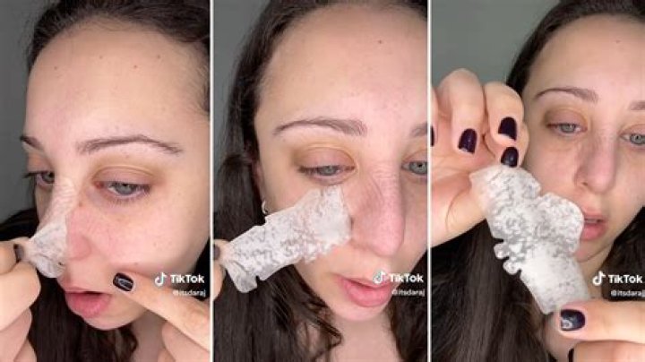 Hero Cosmetics’ Mighty Patch Nose From Amazon Clears Pores Overnight