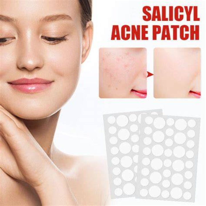 How Do Acne Stickers Actually Work?
