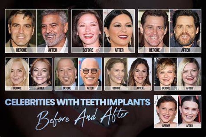 How Do Celebrities Get Herpes?