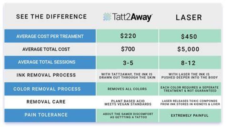 How Much Is Tattoo Removal