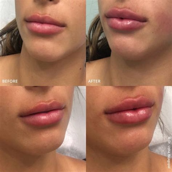 How to Get Smooth Lips Right Now