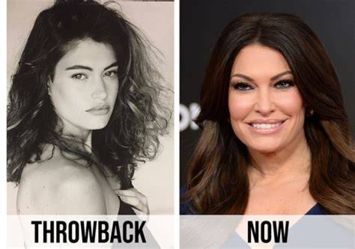Kimberly Guilfoyle Plastic Surgery 2024: A Comprehensive Analysis