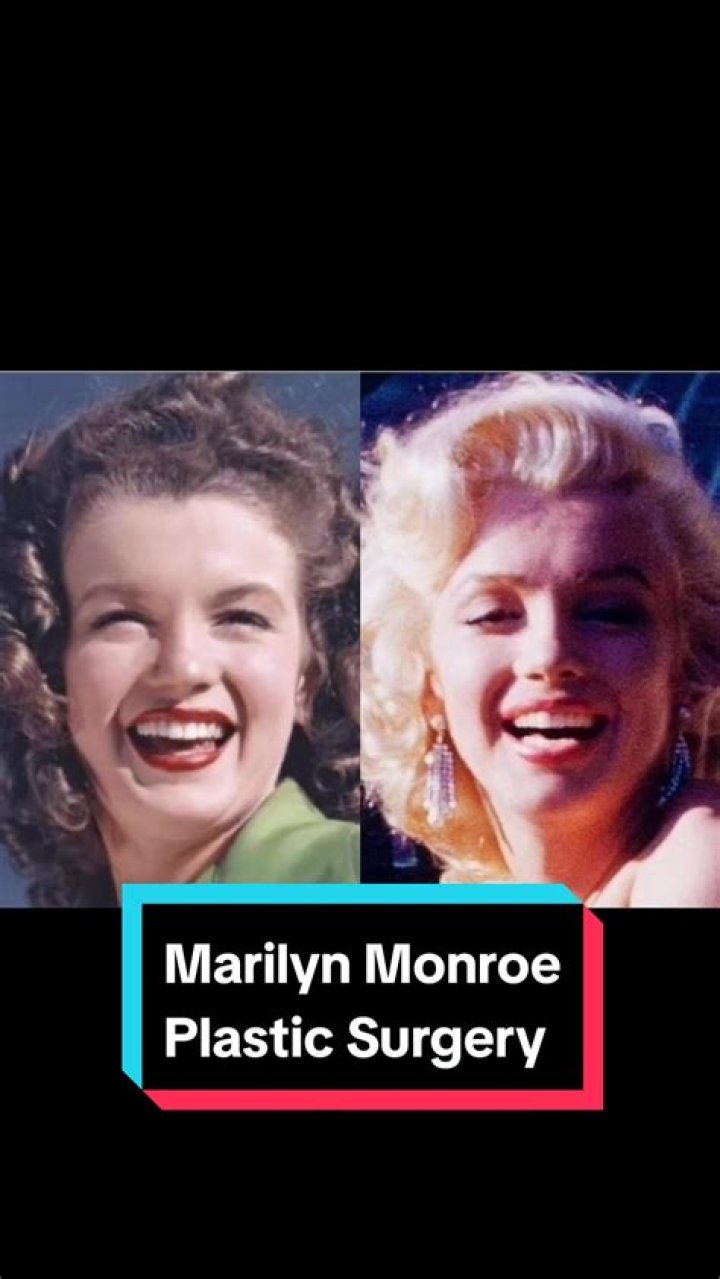 marilyn_monroe platic surgery