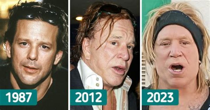 Mickey Rourke - What happened and latest health updates Mickey Rourke - What happened and latest health updates