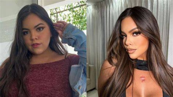 Understanding Gracie Bon Surgeries: A Comprehensive Guide