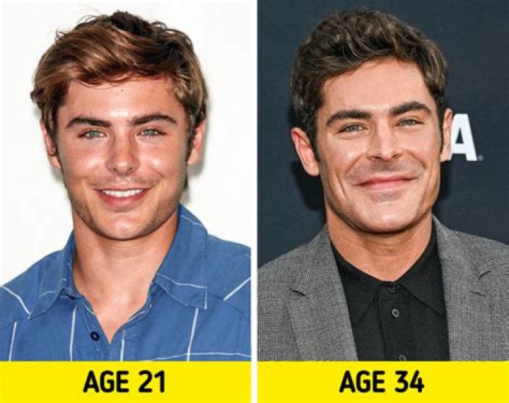 What happened to his face?