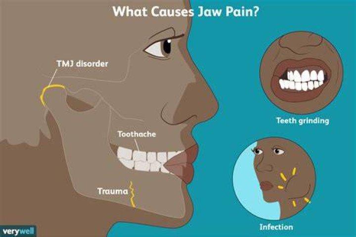 When Yawning Jaw Cramps