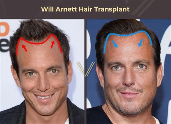 Will Arnett upcoming work Will Arnett upcoming work